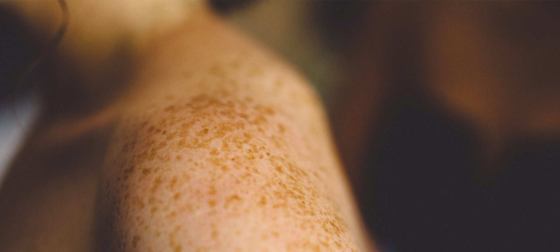 Speciální zimní, po domácku vyrobené scruby, které zklidní naši suchou pleť Hero